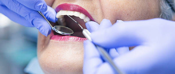 Best Emergency Gum Treatment in Canton, OH